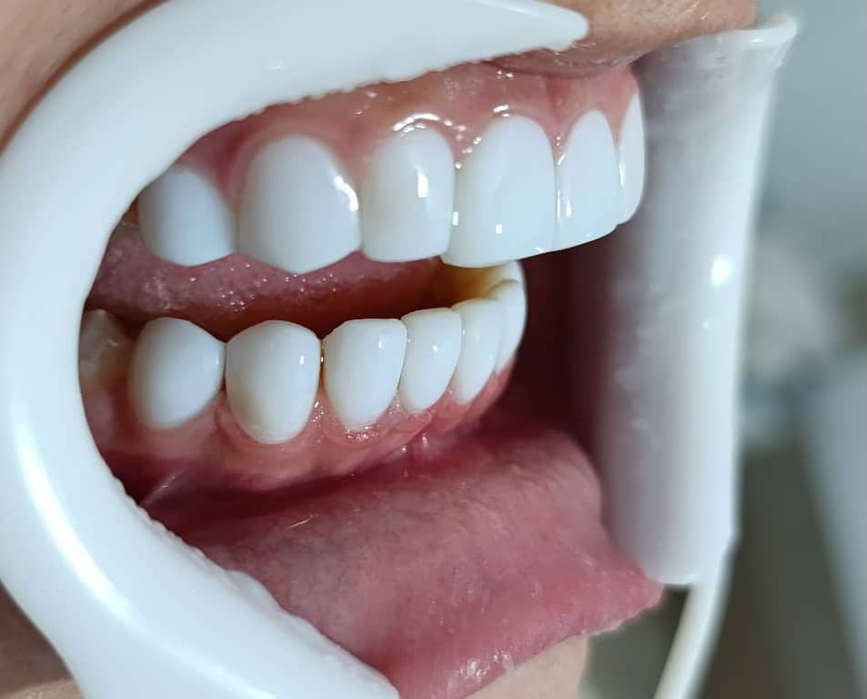 WhatsApp Image 2025 10 27 at 12.45.52 مجتبی صیدی دکتر دندان پزشک