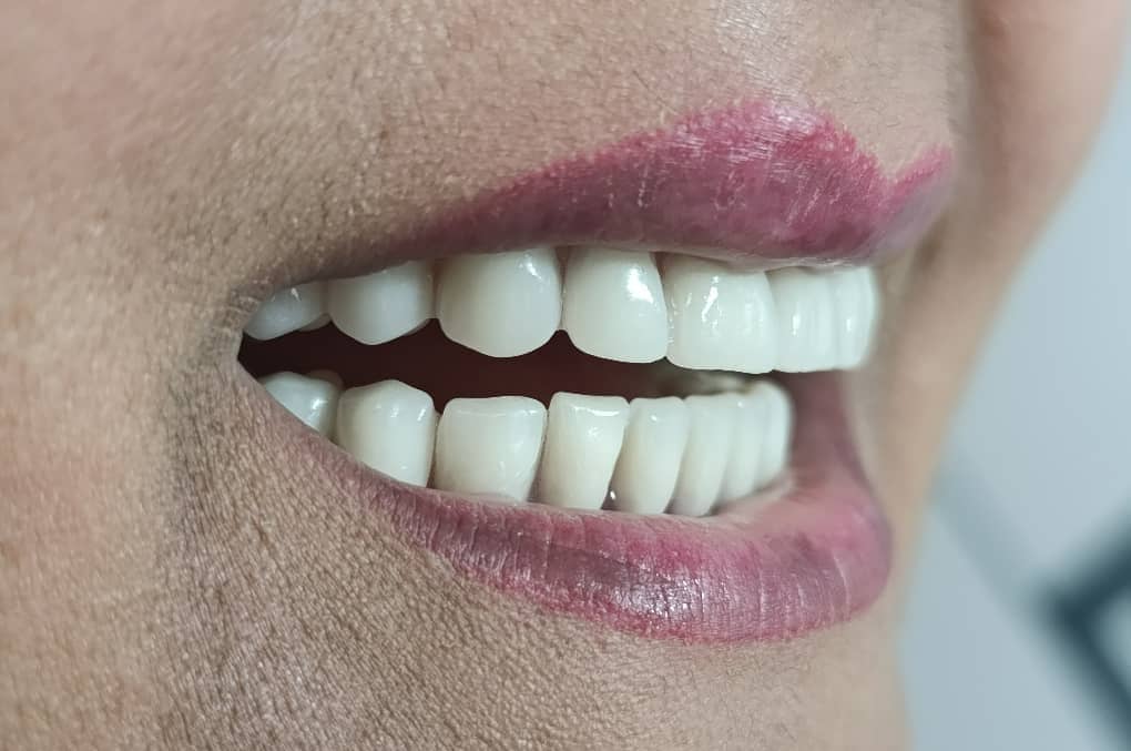 WhatsApp Image 2025 10 27 at 12.49.41 مجتبی صیدی دکتر دندان پزشک