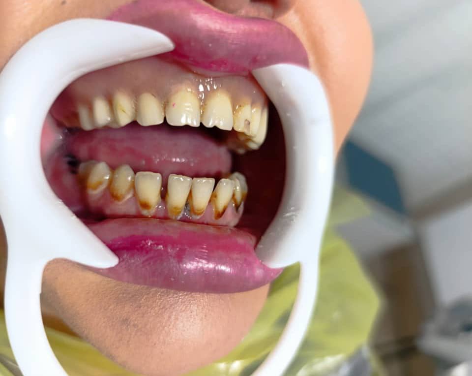 WhatsApp Image 2025 10 27 at 13.08.51 مجتبی صیدی دکتر دندان پزشک