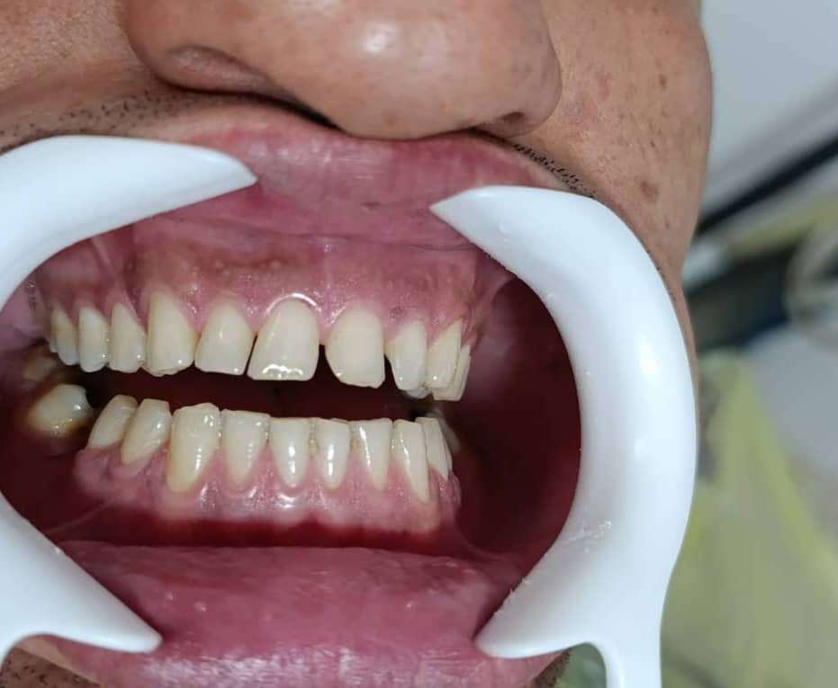 WhatsApp Image 2025 10 27 at 13.50.10 1 مجتبی صیدی دکتر دندان پزشک