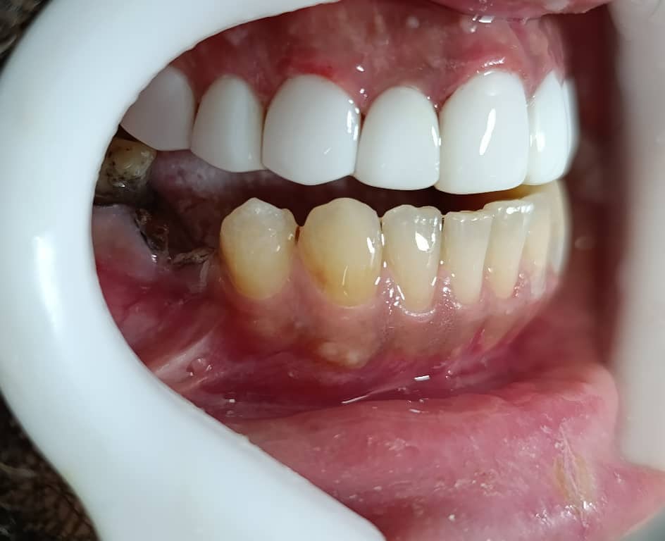 WhatsApp Image 2025 10 27 at 14.01.47 مجتبی صیدی دکتر دندان پزشک