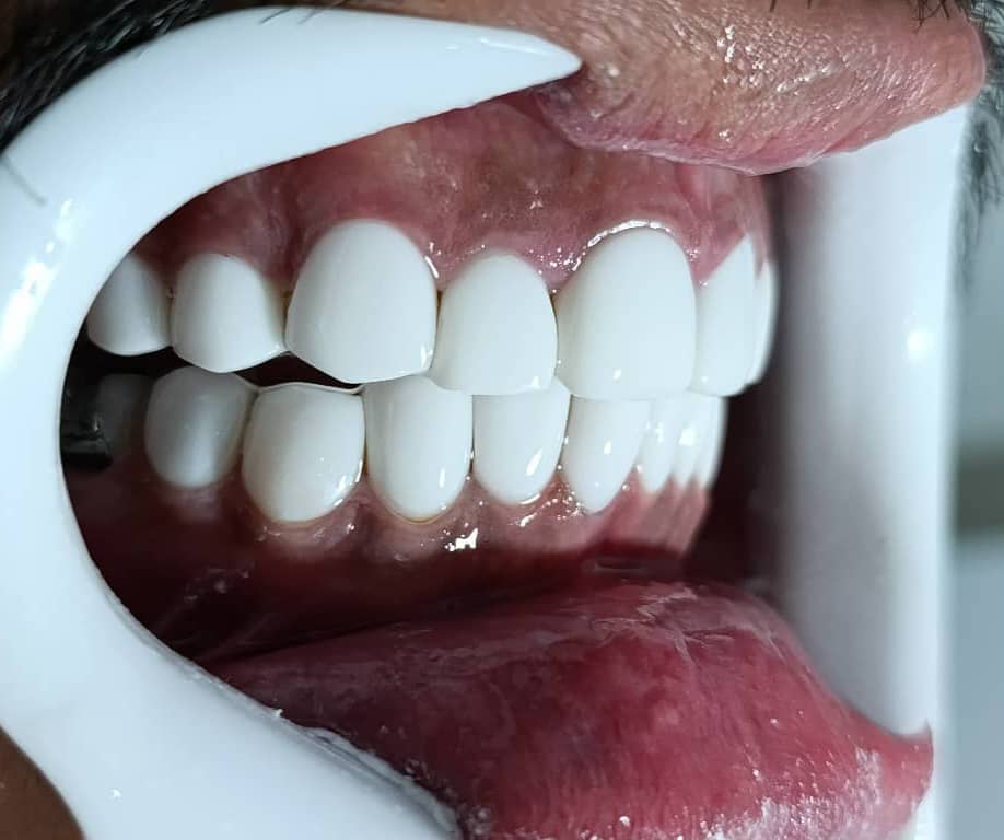 WhatsApp Image 2025 10 27 at 14.10.01 1 مجتبی صیدی دکتر دندان پزشک